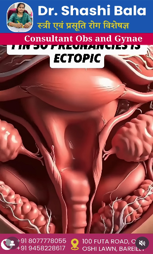 Laparoscopic-Ectopic-Pregnancy-Surgery
