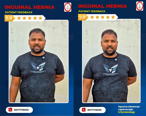 Inguinal-Hernia-Surgery-in-Bareilly