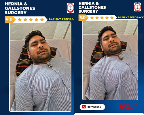 Simultaneous-Hernia-Gallstone-Surgery-in-Bareilly